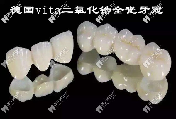 德國vita二氧化鋯全瓷牙冠
