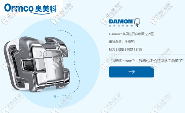 Ormco的damon自鎖托槽參考價(jià)格