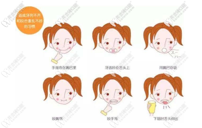 孩子的牙齒畸形可以進(jìn)行矯正