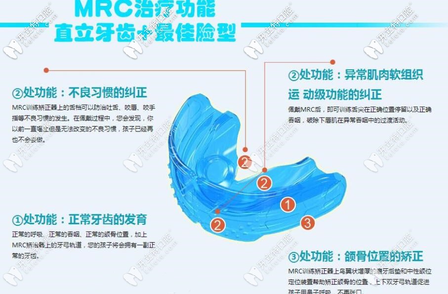 孩子早期牙齒畸形可以用MRC進(jìn)行干預(yù)矯正