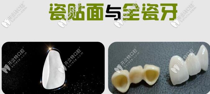 瓷貼面與全瓷牙如何選擇 瓷貼面與全瓷牙如何選擇