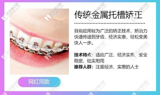 傳統(tǒng)金屬隱形矯正優(yōu)勢(shì)