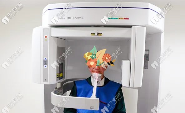 廣州柏德口腔高齡種植牙案例 廣州柏德口腔高齡種植牙案例