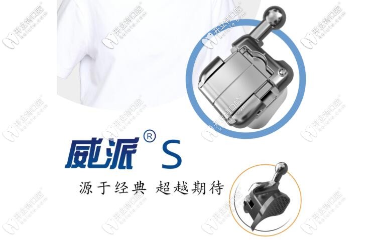 被cue到的國(guó)產(chǎn)威派自鎖托槽咋樣?速看3b威派托槽價(jià)格及原理