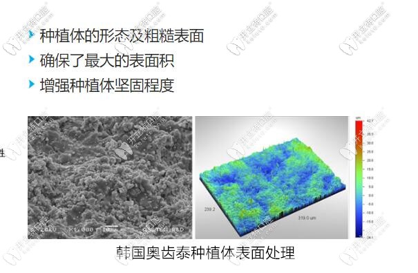 奧齒泰質(zhì)量好不好