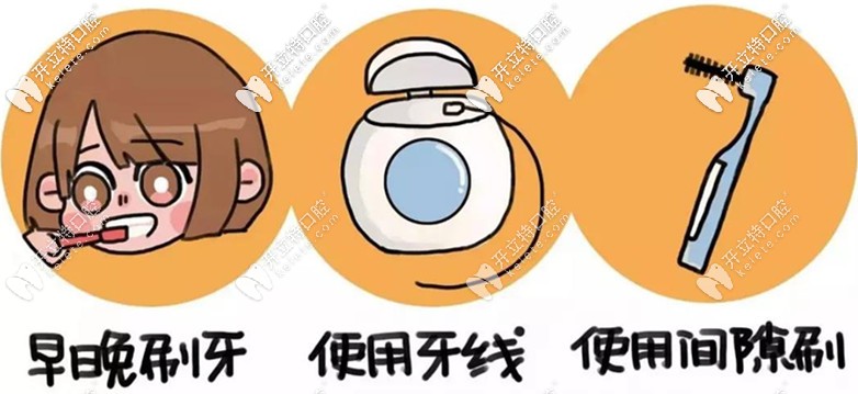 戴牙套后要早晚刷牙喲