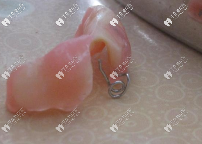 牙齒矯正斜導(dǎo)的作用