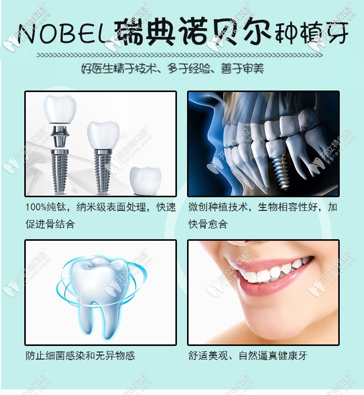 瑞典諾貝爾種植體優(yōu)勢(shì)