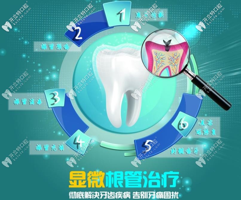 顯微根管治療優(yōu)勢