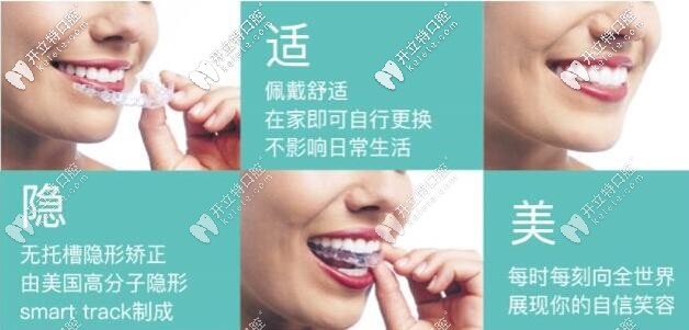 隱適美隱形矯正的優(yōu)勢 隱適美隱形矯正的優(yōu)勢