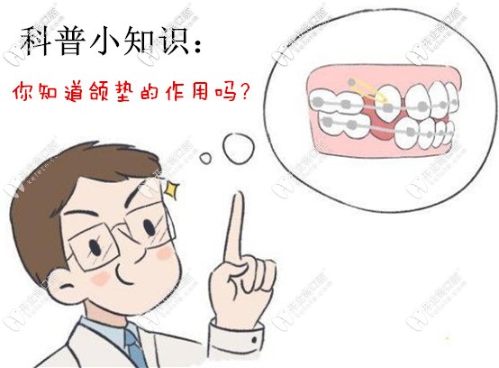 你知道頜墊的作用有哪些嗎