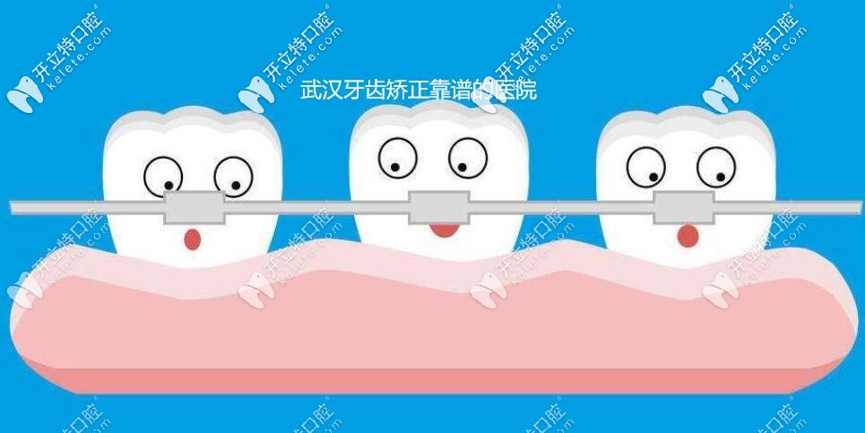 武漢牙齒矯正靠譜的醫(yī)院