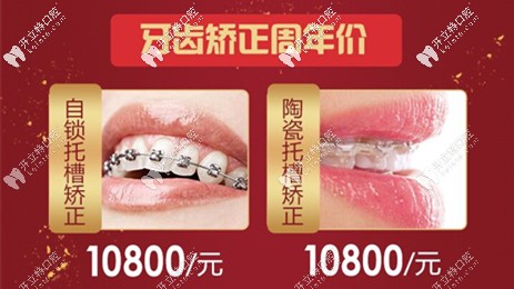 陶瓷托槽和金屬自鎖托槽價(jià)格