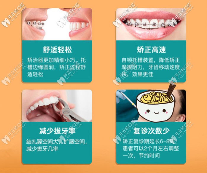 金屬自鎖牙套的優(yōu)點(diǎn)