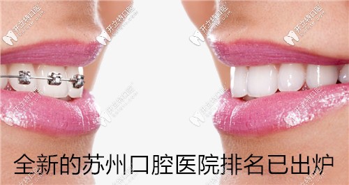 蘇州口腔醫(yī)院排名已發(fā)布！快來看蘇州哪家牙科便宜又好
