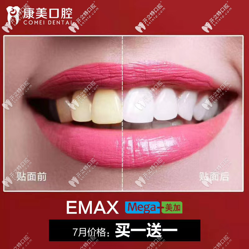 樹脂貼面買一贈一