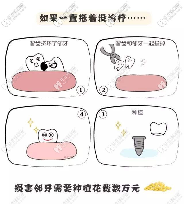 牙齒有問題一定要及時(shí)治療哦