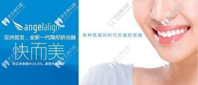 時(shí)代天使隱形矯正