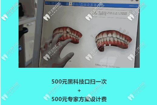 中山好民生口腔口掃體驗