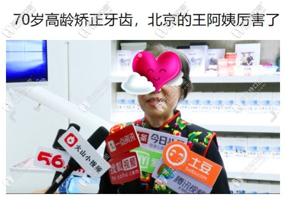 70歲的阿姨做矯正的真人真事