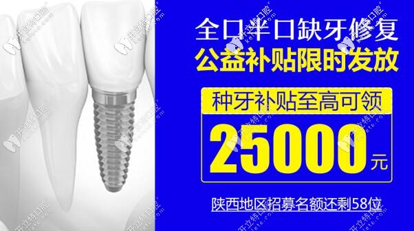 西安種一口牙報價來啦,1顆諾貝爾種植牙的價格就可恢復(fù)半口
