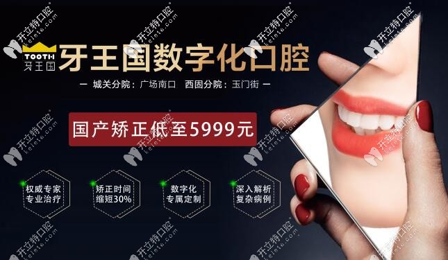 比隱形牙套價(jià)格便宜又快速的金屬矯正只需5999,蘭州人手慢無(wú)