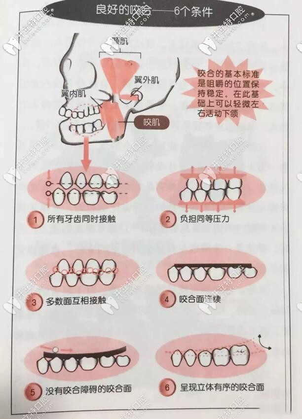 標準的牙齒咬合圖片