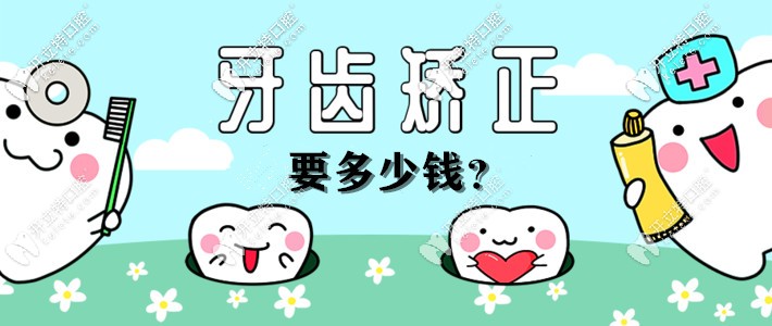 推送一篇牙齒矯正價格表,幫你解答杭州整牙齒一般多少錢