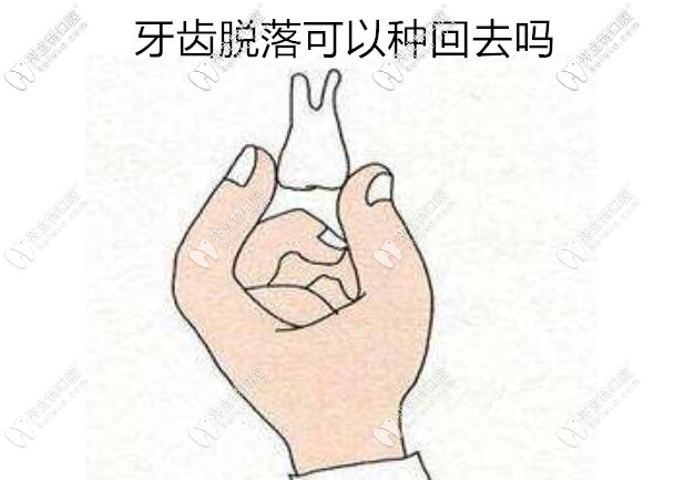 我想對你說：這樣處理脫落的牙齒是可以種回去的哦！