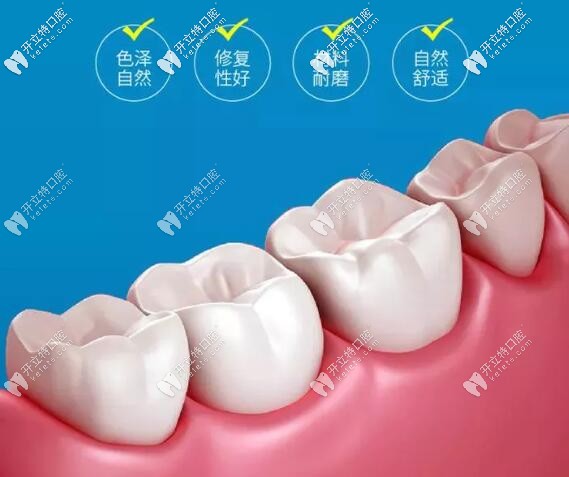 美學(xué)修復(fù) 美學(xué)修復(fù)