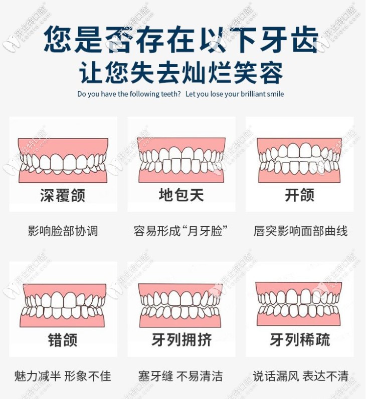 牙齒不齊的類型