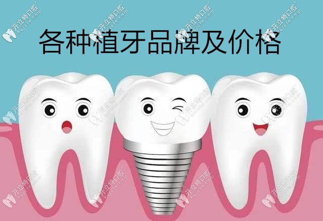 各種植牙品牌及價(jià)格