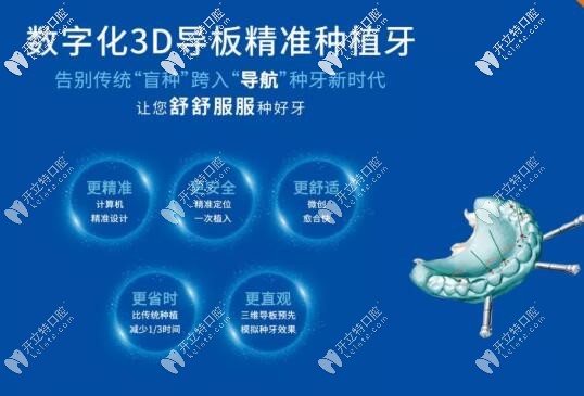 數(shù)字化3d導(dǎo)板種植牙 數(shù)字化3d導(dǎo)板種植牙