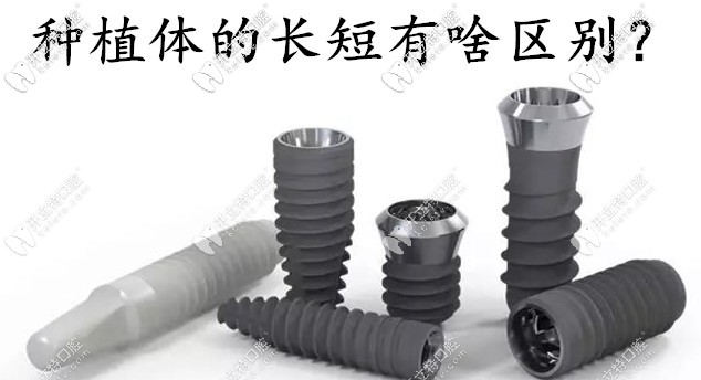 種植體的長短有啥區(qū)別