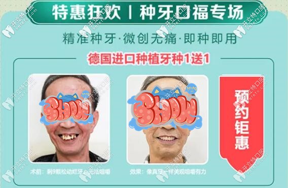 八月廣州廣大口腔的美國進(jìn)口種植牙5750元就能帶走哦