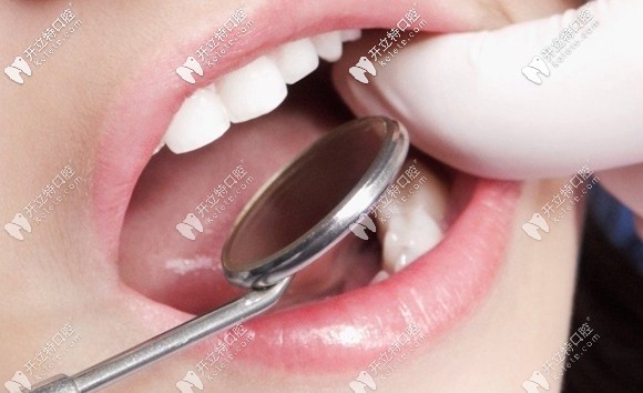 華志熙醫(yī)生建議一定要先治療牙病再矯正 華志熙醫(yī)生建議一定要先治療牙病再矯正