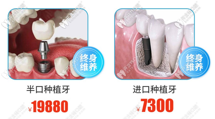 南寧柏樂口腔牙齒種植項目活動