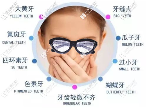 牙齒貼面可以改善九大牙齒問(wèn)題