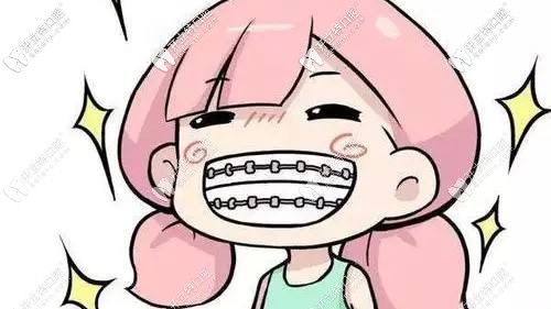 牙齒矯正戴牙套會損傷牙釉質(zhì)嗎