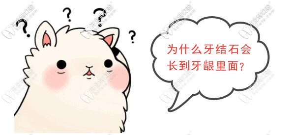 為什么牙結(jié)石會長到牙齦里面？