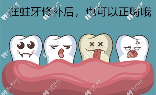 蛀牙顆數(shù)超過20顆可能就正畸無望了