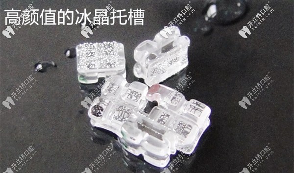 bling bling的冰晶托槽半隱形矯正價(jià)格也沒想象中辣么貴嘛~