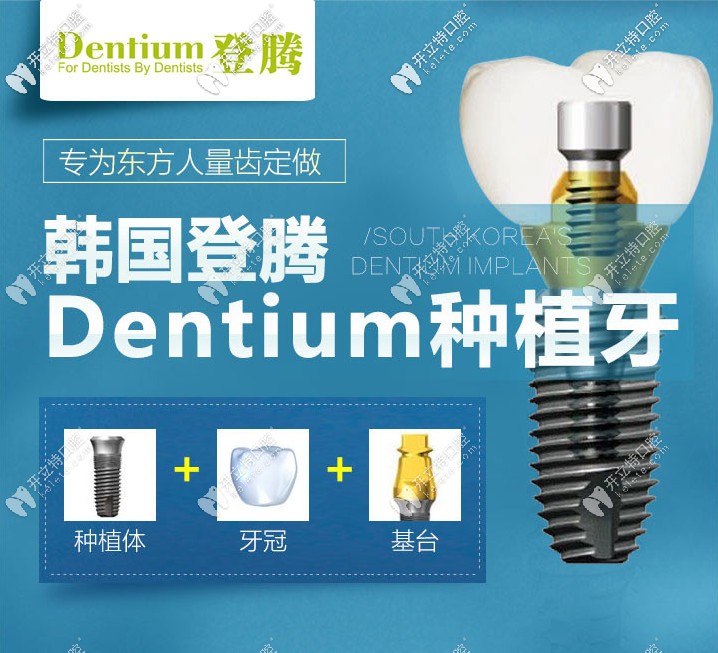 南京做韓國(guó)登騰種植牙多少錢(qián)？它的使用壽命有多長(zhǎng)呢？