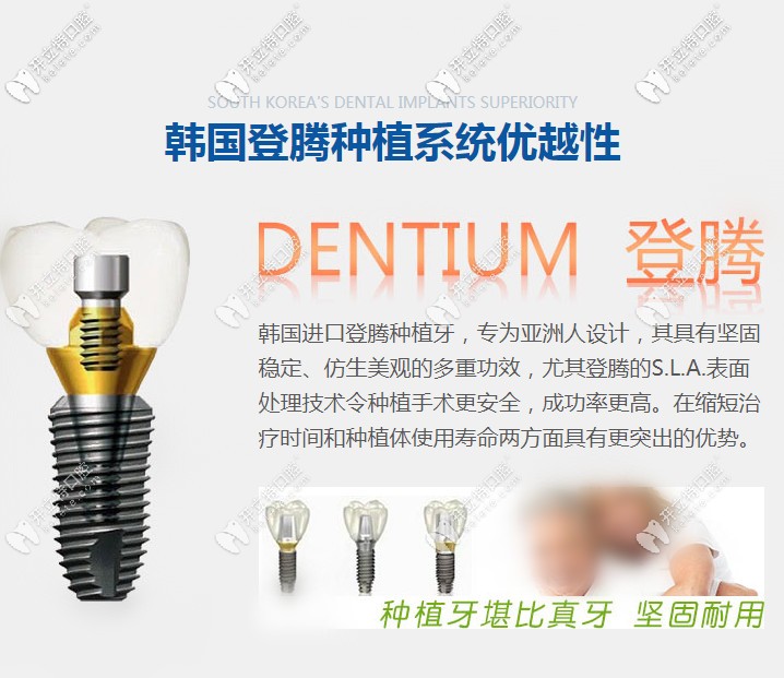 韓國登騰種植牙的優(yōu)勢