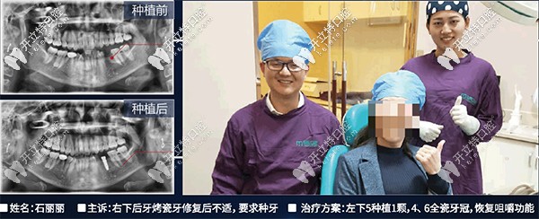 昆明尚愛韓美李兵做韓國(guó)dentium<span style=