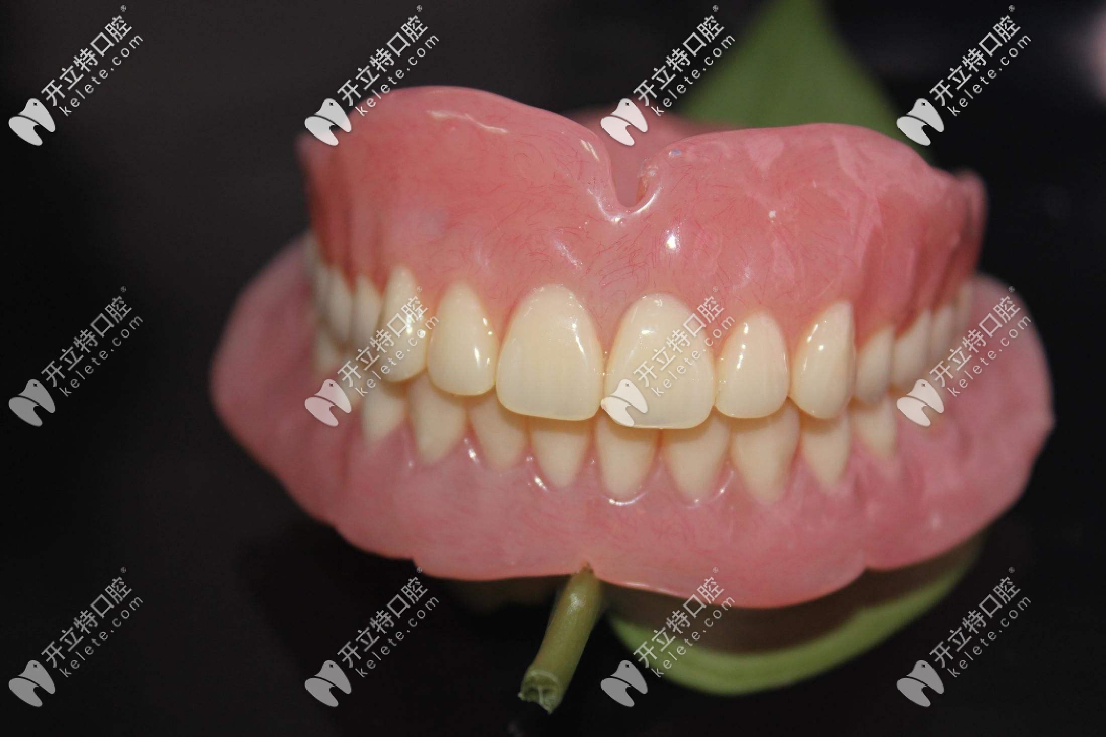 為什么選擇吸附性義齒