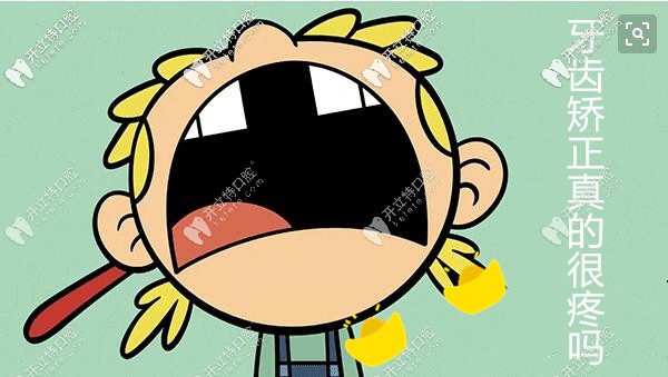 牙齒矯正痛苦的階段你了解嗎?別在矯正中被打支抗釘嚇退