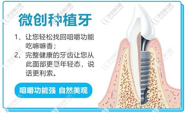 廣州穗江口腔微創(chuàng)即刻種植牙技術 廣州穗江口腔微創(chuàng)即刻種植牙技術