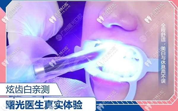 曙光口腔正畸科李醫(yī)生親測炫齒白的過程