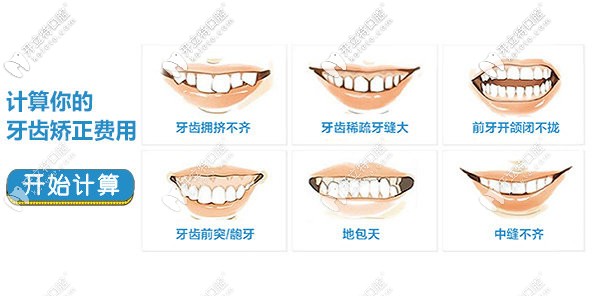 牙齒矯正的不同情況